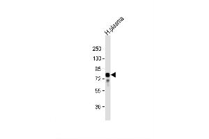 Image no. 6 for anti-Vitronectin (VTN) (AA 65-93), (N-Term) antibody (ABIN652347)