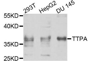 Image no. 1 for anti-Tocopherol (Alpha) Transfer Protein (TTPA) antibody (ABIN4905515)