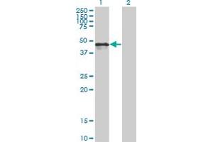 Image no. 3 for anti-Calreticulin (CALR) (AA 1-417) antibody (ABIN560152)