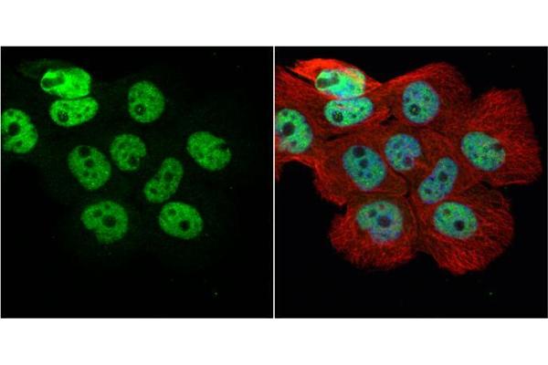 HNRNPH1 antibody