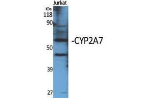 Image no. 1 for anti-Cytochrome P450, Family 2, Subfamily A, Polypeptide 7 (CYP2A7) (C-Term) antibody (ABIN3184174)