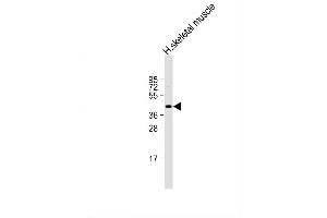 Image no. 3 for anti-Myostatin (MSTN) (AA 9-38), (N-Term) antibody (ABIN388821)