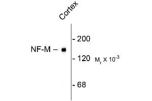Image no. 1 for anti-Neurofilament Triplet M Protein (NEFM) (C-Term) antibody (ABIN361354)