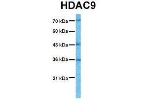 Image no. 4 for anti-Histone Deacetylase 9 (HDAC9) (C-Term) antibody (ABIN2775576)