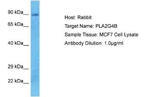 Image no. 1 for anti-Phospholipase A2, Group IVB (Cytosolic) (PLA2G4B) (C-Term) antibody (ABIN2789285)