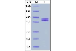 Image no. 2 for Complement Component 5a (C5a) (AA 679-751) (Active) protein (Fc Tag) (ABIN6938863)
