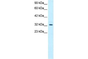 Image no. 5 for anti-T-Cell Acute Lymphocytic Leukemia 1 (TAL1) (C-Term) antibody (ABIN2792541)
