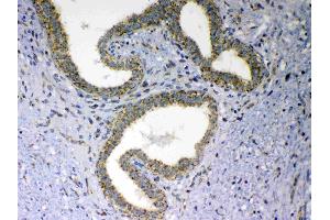 Image no. 5 for anti-Mitochondrial Antiviral Signaling Protein (MAVS) (AA 34-96) antibody (ABIN5518935)