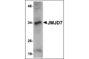 Image no. 2 for anti-Jumonji Domain Containing 7 (JMJD7) (C-Term) antibody (ABIN500090)