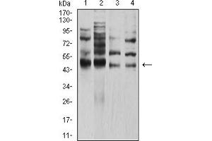 Image no. 4 for anti-Transcription Factor AP-2 alpha (Activating Enhancer Binding Protein 2 Alpha) (TFAP2A) (AA 105-211) antibody (ABIN5611192)