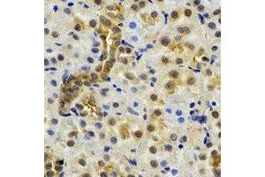 Image no. 3 for anti-N(alpha)-Acetyltransferase 50, NatE Catalytic Subunit (NAA50) antibody (ABIN2966830)