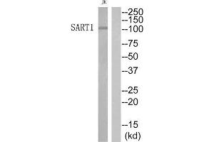 Image no. 1 for anti-Squamous Cell Carcinoma Antigen Recognized By T Cells (SART1) (Internal Region) antibody (ABIN1852322)