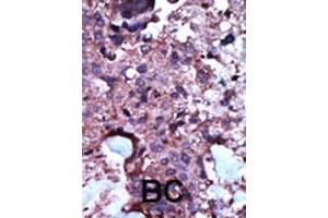 Image no. 2 for anti-Pyruvate Kinase, Liver and RBC (PKLR) (AA 1-30), (N-Term) antibody (ABIN391050)