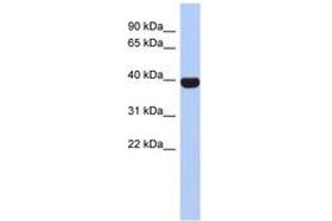 Image no. 1 for anti-Neurogenic Differentiation 4 (NEUROD4) (AA 215-264) antibody (ABIN6742269)