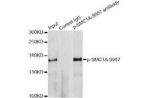 Image no. 7 for anti-Structural Maintenance of Chromosomes 1A (SMC1A) (pSer957) antibody (ABIN3019554)