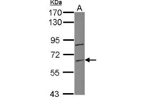 Image no. 1 for anti-Zinc Finger Protein 282 (ZNF282) (AA 46-303) antibody (ABIN1501833)
