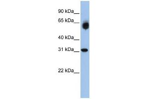 Image no. 1 for anti-Dehydrogenase/reductase (SDR Family) Member 2 (DHRS2) (Middle Region) antibody (ABIN2775325)