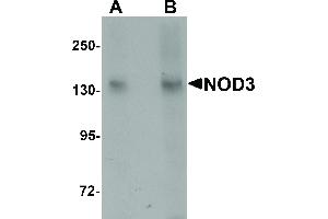 Image no. 1 for anti-NLR Family, CARD Domain Containing 3 (NLRC3) (Internal Region) antibody (ABIN6657234)