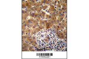 Image no. 2 for anti-PHD Finger Protein 17 (PHF17) (N-Term) antibody (ABIN2492567)