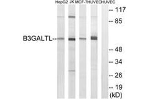 Image no. 1 for anti-beta 1,3-Galactosyltransferase-Like (B3GALTL) (AA 449-498) antibody (ABIN1534691)