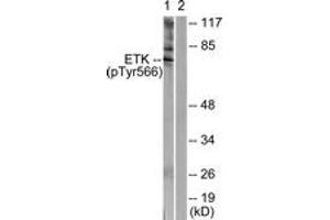 Western blot analysis of extracts from HeLa cells treated with Serum 20% 15', using ETK (Phospho-Tyr566) Antibody.