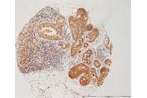Image no. 1 for anti-Melanoma Associated Chondroitin Sulfate Proteoglycan (MCSP) (AA 950-1000), (Extracellular Domain) antibody (ABIN571645)