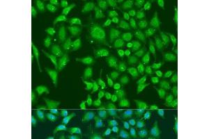 Immunofluorescence analysis of U2OS cells using CENPQ Polyclonal Antibody at dilution of 1:100.