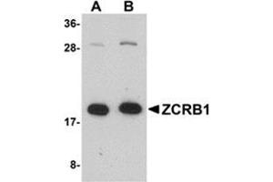 Image no. 1 for anti-Zinc Finger CCHC-Type and RNA Binding Motif 1 (ZCRB1) (C-Term) antibody (ABIN501157)