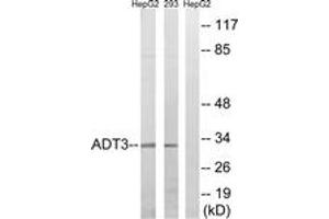 Image no. 1 for anti-Solute Carrier Family 25 (Mitochondrial Carrier, Adenine Nucleotide Translocator), Member 6 (SLC25A6) (AA 121-170) antibody (ABIN1534604)
