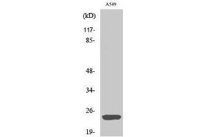 Image no. 1 for anti-ADP-Ribosylation Factor-Like 2 Binding Protein (ARL2BP) (Internal Region) antibody (ABIN3183482)