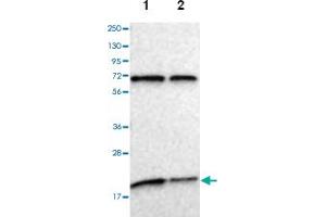 Image no. 2 for anti-Magnesium-Dependent Phosphatase 1 (MDP1) antibody (ABIN5583369)
