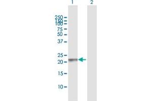 Image no. 1 for anti-RAB13, Member RAS Oncogene Family (RAB13) (AA 1-203) antibody (ABIN519587)