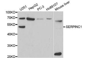 Image no. 2 for anti-Serine (Or Cysteine) Peptidase Inhibitor, Clade C (Antithrombin), Member 1 (SERPINC1) antibody (ABIN3022165)
