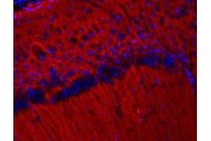Image no. 2 for anti-Synaptic Vesicle Glycoprotein 2B (SV2B) (AA 2-17) antibody (ABIN1742259)