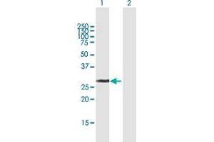 Image no. 1 for anti-Uridine-Cytidine Kinase 2 (UCK2) (AA 1-261) antibody (ABIN948614)