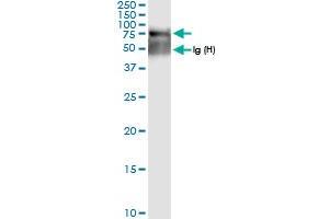 Image no. 2 for anti-N-Sulfoglucosamine Sulfohydrolase (SGSH) (AA 1-502) antibody (ABIN948461)