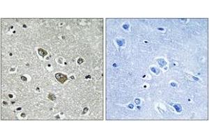 Image no. 2 for anti-Zinc Finger, DHHC-Type Containing 9 (ZDHHC9) (AA 315-364) antibody (ABIN1535143)