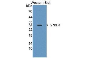 Image no. 1 for anti-Calcium Binding Protein P22 (CHP) (AA 2-195) antibody (ABIN5013275)