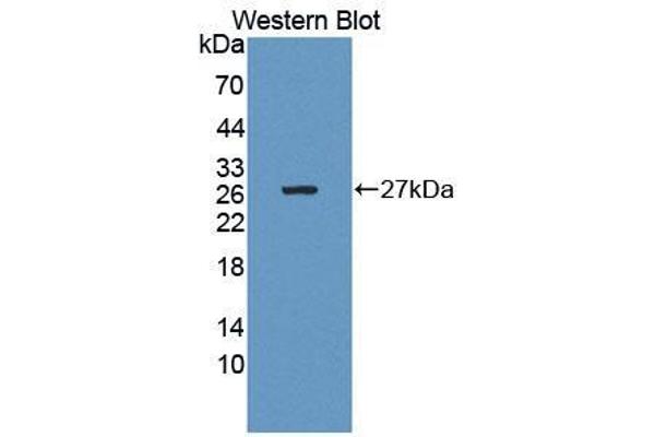 anti-Calcium Binding Protein P22 (CHP) (AA 2-195) antibody