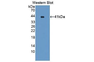 Image no. 1 for anti-alpha Ketoglutarate Dehydrogenase (alphaKGDHC) (AA 256-582) antibody (ABIN1869609)