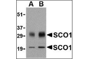 Image no. 2 for anti-SCO1 Cytochrome C Oxidase Assembly Protein (SCO1) (Center) antibody (ABIN500686)