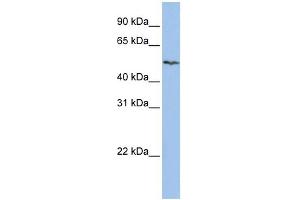 anti-Solute Carrier Family 16 (Monocarboxylic Acid Transporters), Member 6 (SLC16A6) (Middle Region) antibody