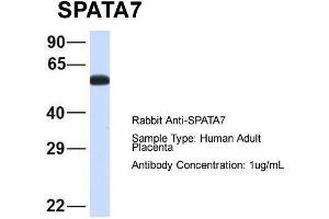Image no. 4 for anti-Spermatogenesis Associated 7 (SPATA7) (Middle Region) antibody (ABIN2787132)