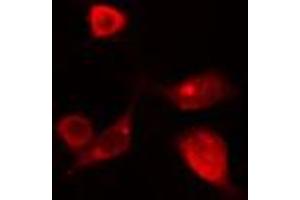 Image no. 2 for anti-T-Box 10 (TBX10) (Internal Region) antibody (ABIN6258333)