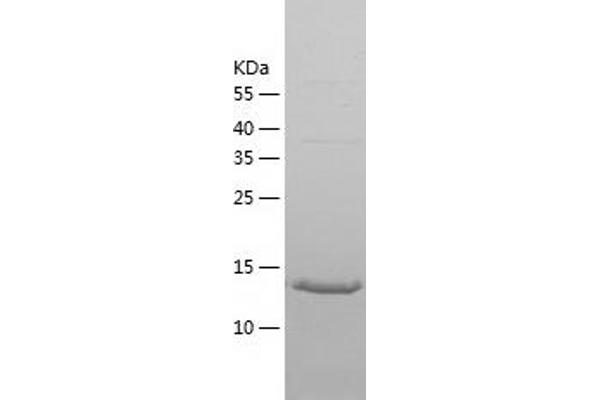 G Antigen 2A Protein (GAGE2A) (AA 1-116) (His tag)