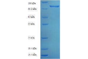P4HA3 Protein (AA 20-544) (His-SUMO Tag)