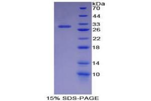 Image no. 1 for Inhibitor of KB Kinase beta Interacting Protein (IKbIP) protein (ABIN3009956)