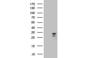 Image no. 3 for anti-Mitochondrial Translational Initiation Factor 3 (MTIF3) (AA 56-278) antibody (ABIN1491590)