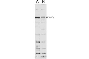 Image no. 1 for anti-DCN1, Defective in Cullin Neddylation 1, Domain Containing 2 (DCUN1D2) (N-Term) antibody (ABIN2774501)