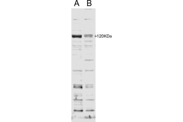 anti-DCN1, Defective in Cullin Neddylation 1, Domain Containing 2 (DCUN1D2) (N-Term) antibody